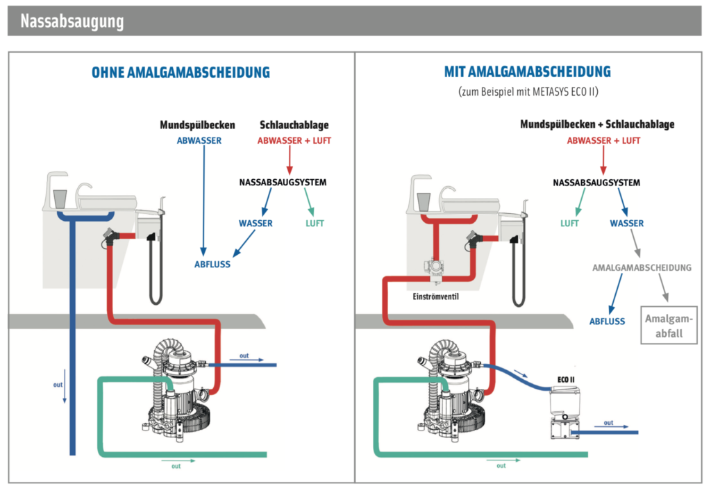 Nassabsaugung mit und ohne Amalgamabscheidung (Illustration von METASYS)
