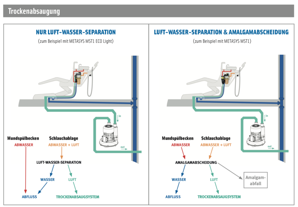 Trockenabsaugung mit und ohne Amalgamabscheidung (Illustration von METASYS)